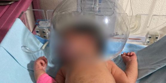Improvisación médica en Tabasco revela carencia de insumos en hospital del IMSS-Bienestar